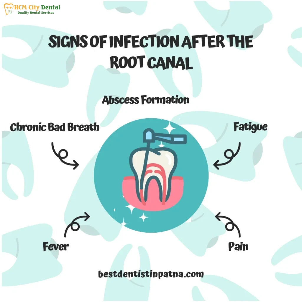 bad-breath-after-root-canal-treatment-5-dr-cuong-hcmc-dental-clinic-dr-cuong-hcmc-dental-clinic
