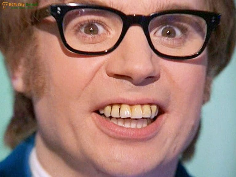 Do British Have Bad Teeth? The Surprising Truth [Debunked] | Dr. Cuong
