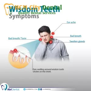 can-headaches-be-caused-by-wisdom-teeth-4-dr-cuong-hcmc-dental-clinic-dr-cuong-hcmc-dental-clinic