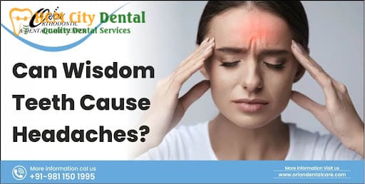 can-headaches-be-caused-by-wisdom-teeth-5-dr-cuong-hcmc-dental-clinic-dr-cuong-hcmc-dental-clinic