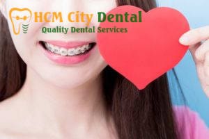 can-people-with-braces-kiss-6-dr-cuong-hcmc-dental-clinic-dr-cuong-hcmc-dental-clinic