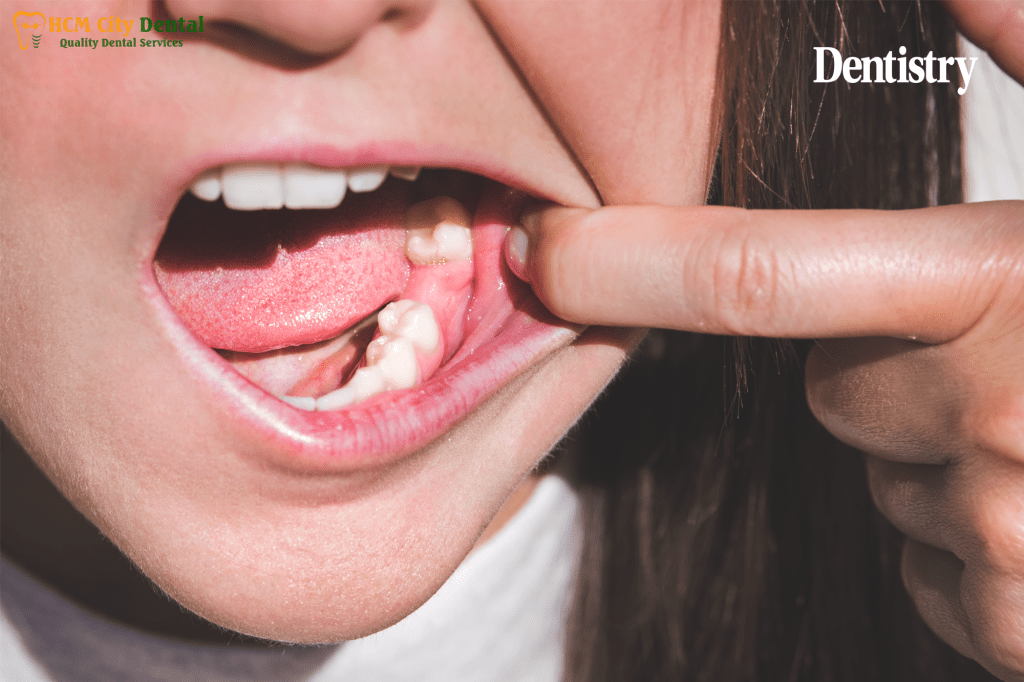 can-teeth-regrow-2-dr-cuong-hcmc-dental-clinic-dr-cuong-hcmc-dental-clinic