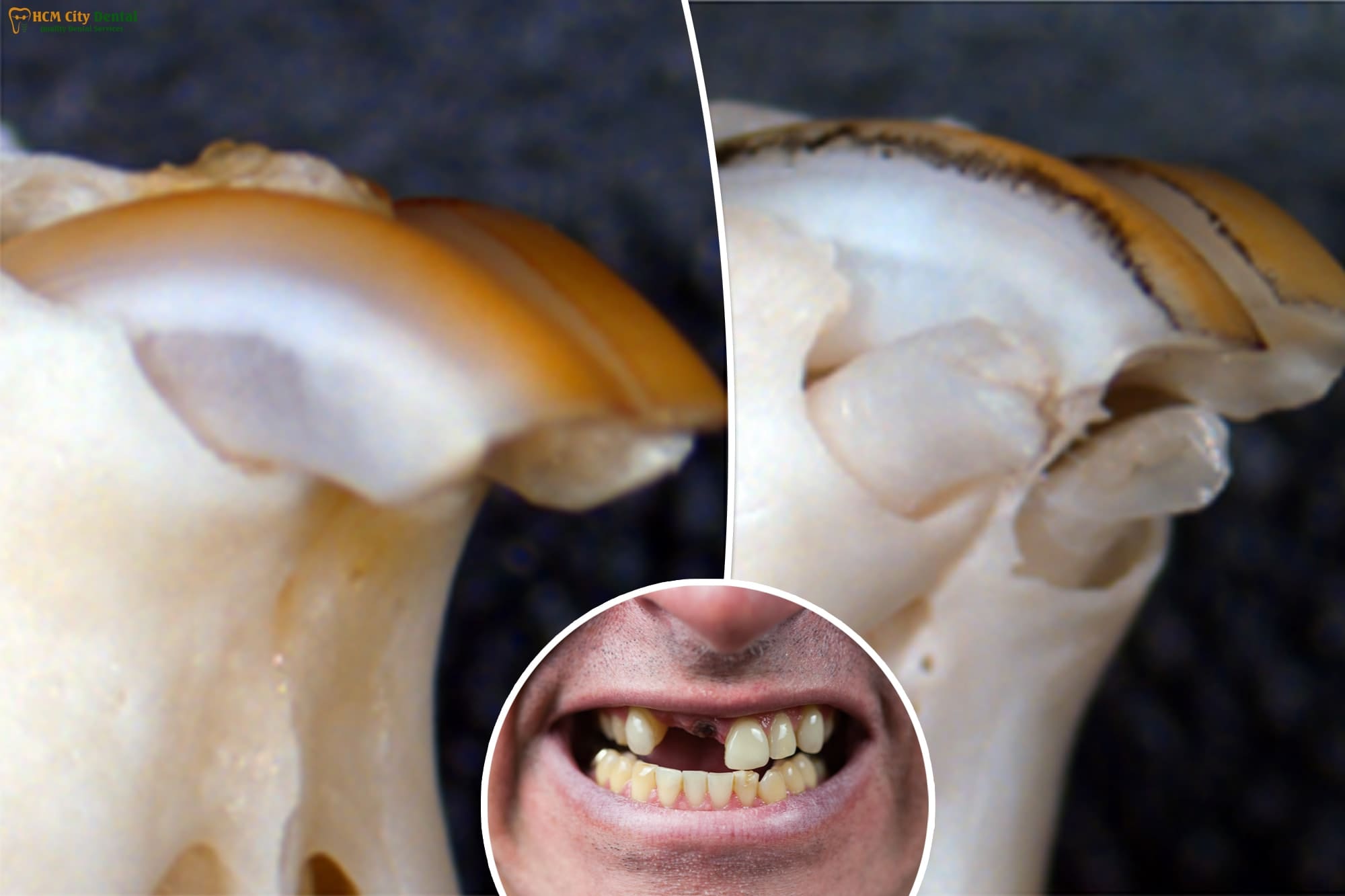 can-teeth-regrow-3-dr-cuong-hcmc-dental-clinic-dr-cuong-hcmc-dental-clinic