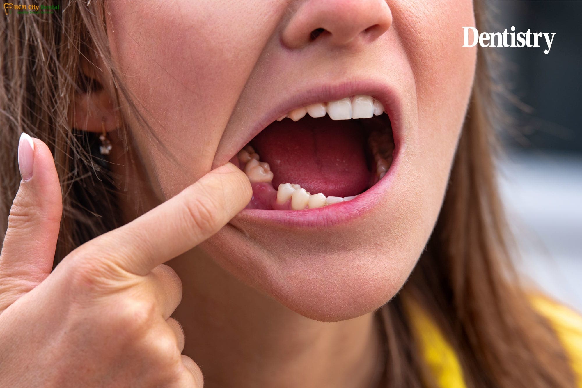 can-teeth-regrow-5-dr-cuong-hcmc-dental-clinic-dr-cuong-hcmc-dental-clinic