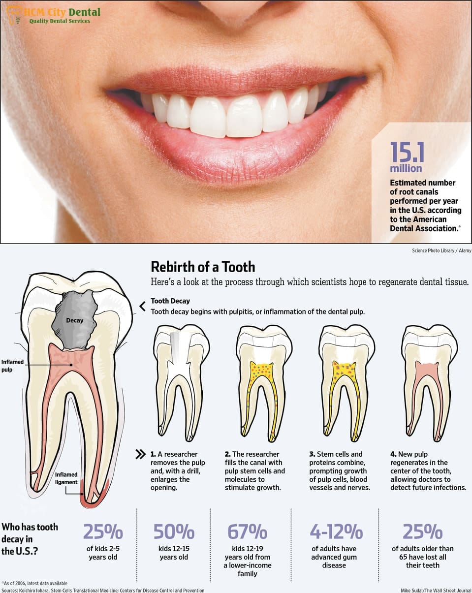 can-teeth-regrow-6-dr-cuong-hcmc-dental-clinic-dr-cuong-hcmc-dental-clinic