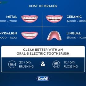 Cost of Orthodontics: How to Save Thousands! | Dr. Cuong