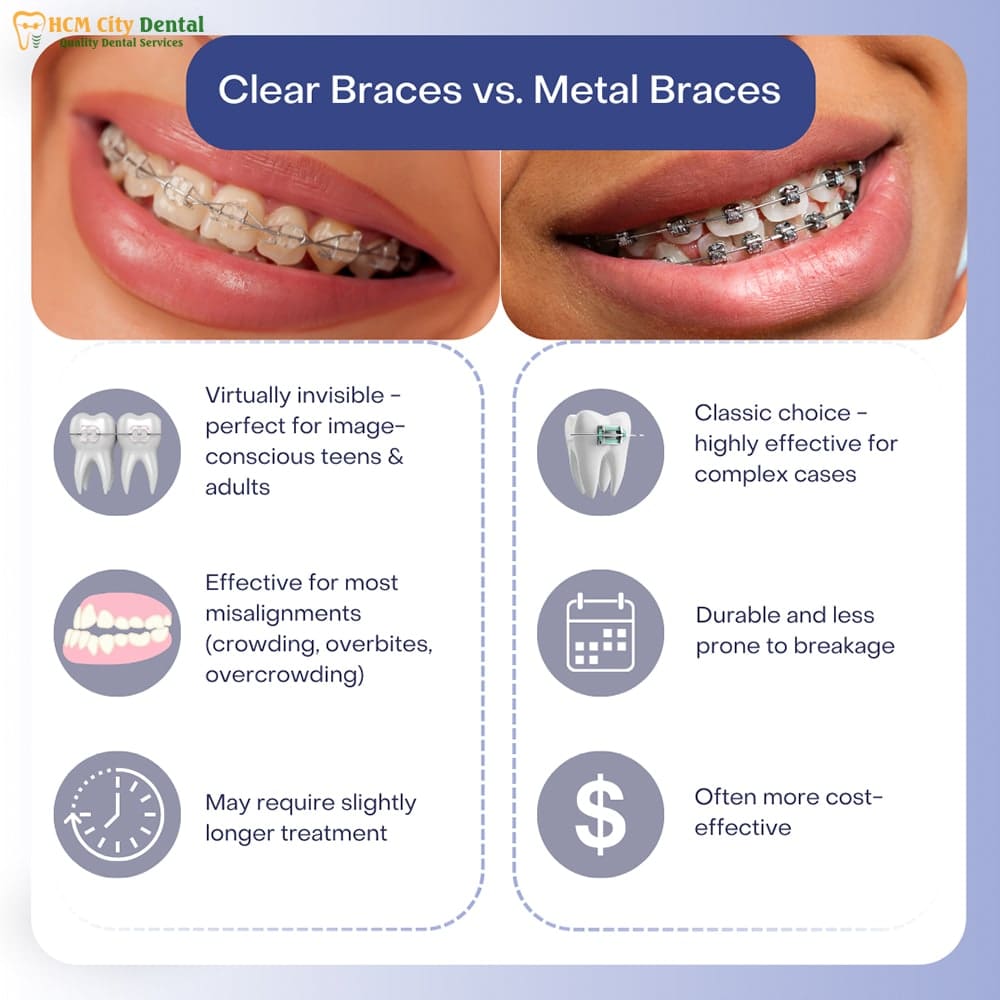cost-of-orthodontics-4-dr-cuong-hcmc-dental-clinic-dr-cuong-hcmc-dental-clinic