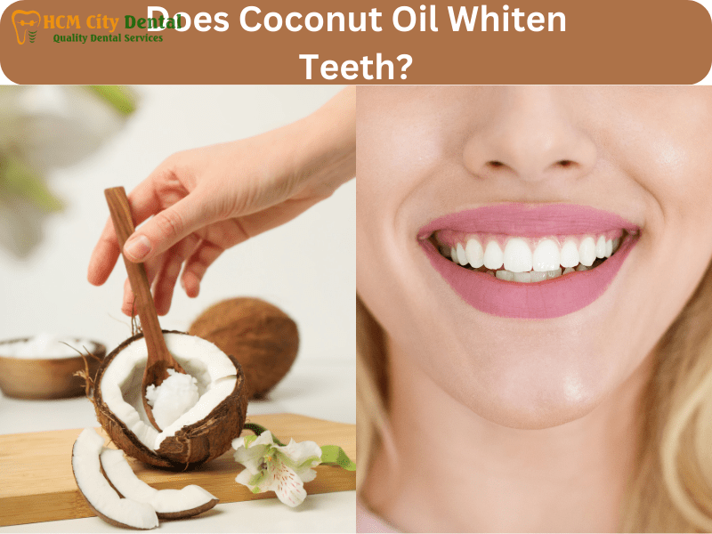 does-coconut-oil-make-teeth-whiter-2-dr-cuong-hcmc-dental-clinic-dr-cuong-hcmc-dental-clinic