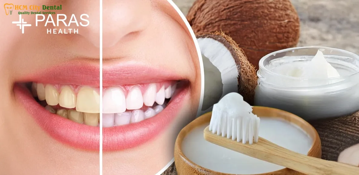does-coconut-oil-make-teeth-whiter-4-dr-cuong-hcmc-dental-clinic-dr-cuong-hcmc-dental-clinic