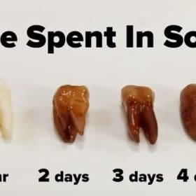 Effects of Sugar on Teeth: Stop Damage & Keep Your Smile | Dr. Cuong