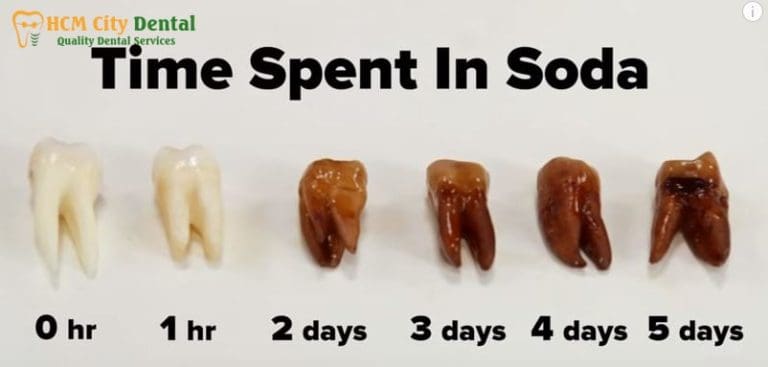 Effects of Sugar on Teeth: Stop Damage & Keep Your Smile | Dr. Cuong