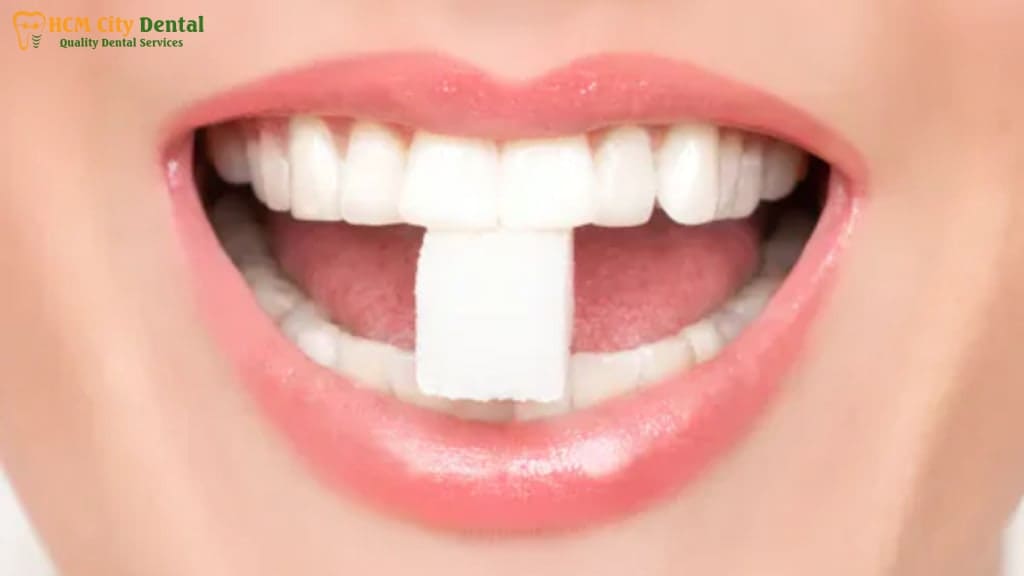 effects-of-sugar-on-teeth-6-dr-cuong-hcmc-dental-clinic-dr-cuong-hcmc-dental-clinic