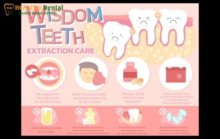 how-long-after-wisdom-teeth-removal-can-i-work-out-4-dr-cuong-hcmc-dental-clinic-dr-cuong-hcmc-dental-clinic