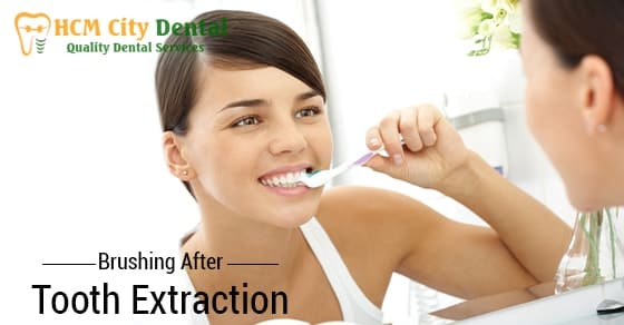 how-to-brush-your-teeth-after-wisdom-teeth-removal-6-dr-cuong-hcmc-dental-clinic-dr-cuong-hcmc-dental-clinic