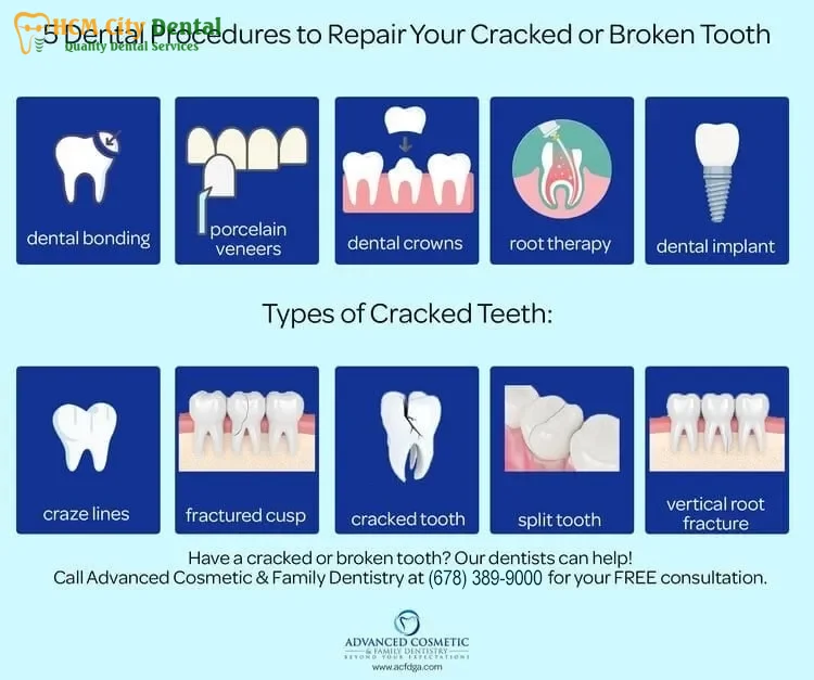 how-to-fix-a-fractured-tooth-2-dr-cuong-hcmc-dental-clinic-dr-cuong-hcmc-dental-clinic