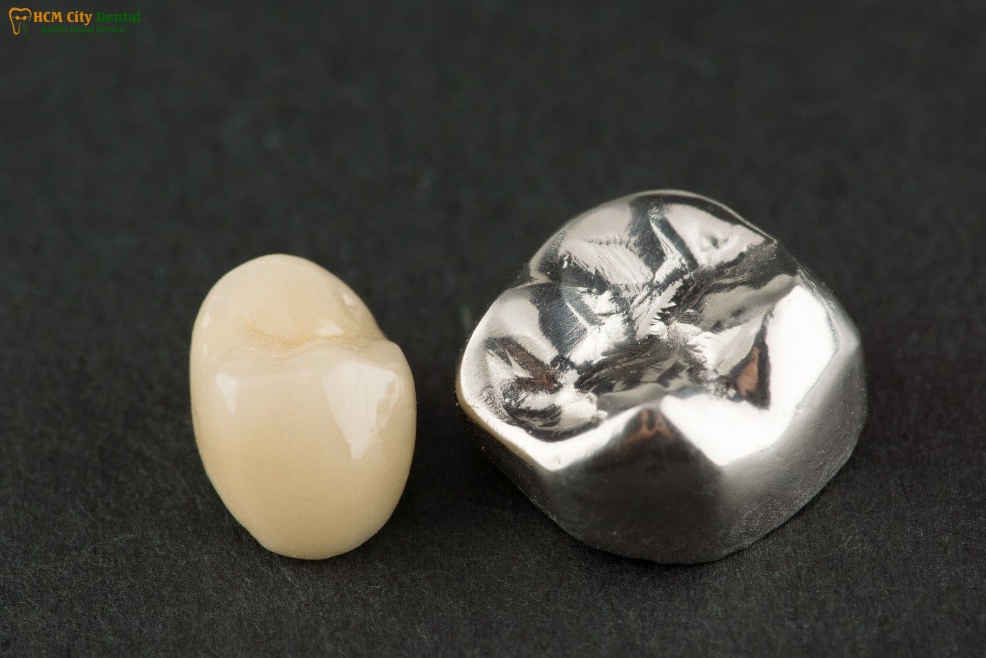 metal-crown-tooth-2-dr-cuong-hcmc-dental-clinic-dr-cuong-hcmc-dental-clinic