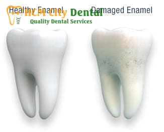 protect-tooth-enamel-2-dr-cuong-hcmc-dental-clinic-dr-cuong-hcmc-dental-clinic