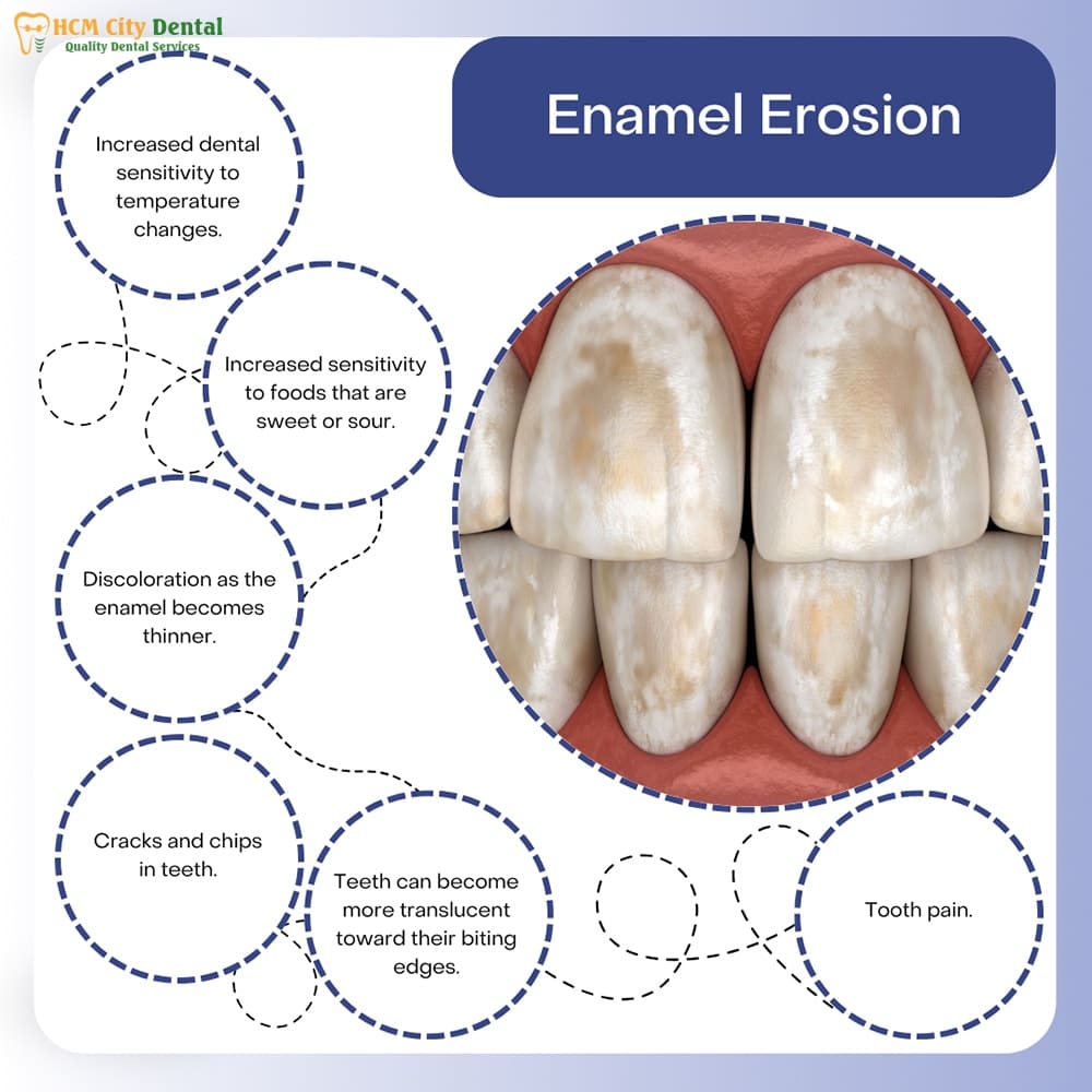 protect-tooth-enamel-6-dr-cuong-hcmc-dental-clinic-dr-cuong-hcmc-dental-clinic