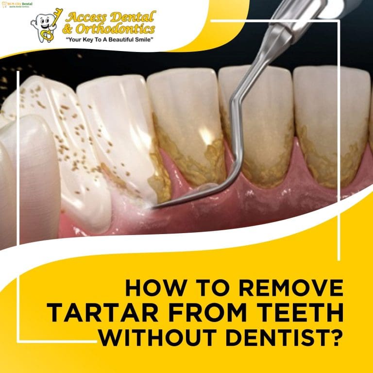 Remove Plaque From Teeth: Avoid These 3 Mistakes! | Dr. Cuong