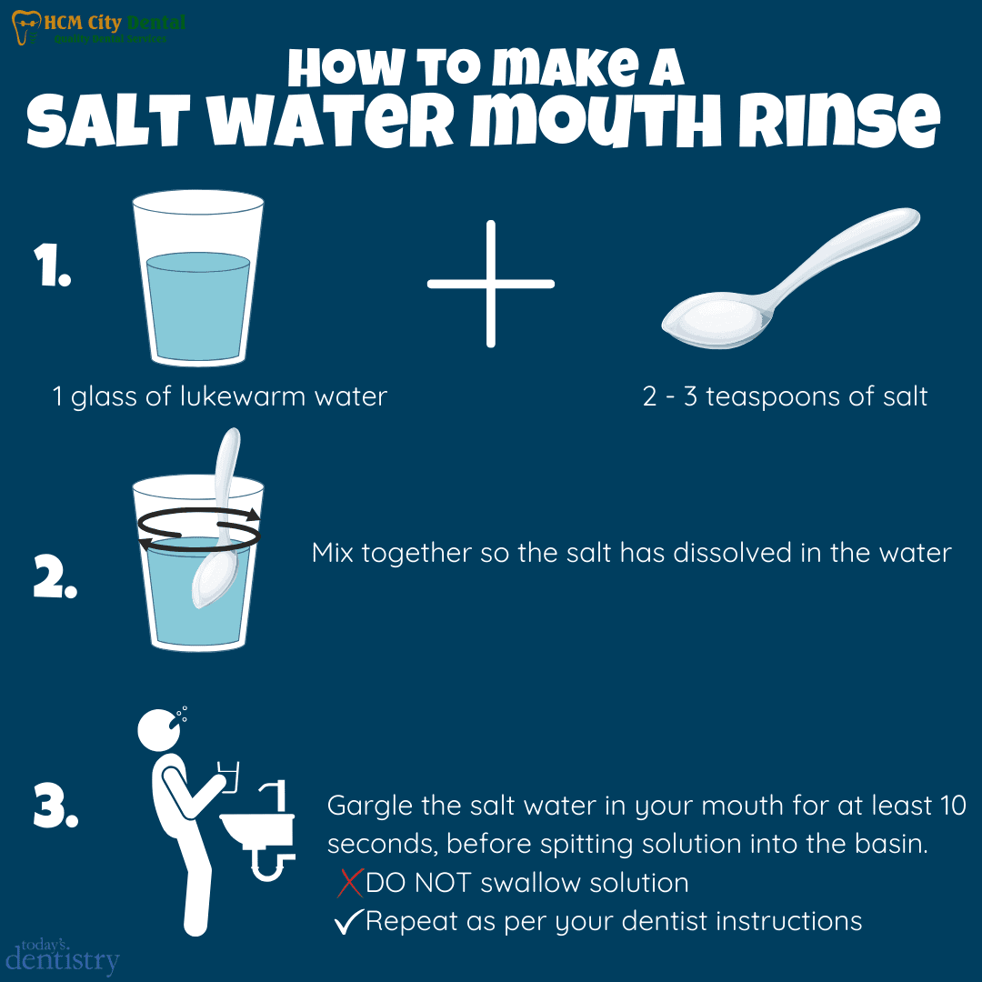 Salt Water Gargle for Tooth Pain: Quick Relief! | Dr. Cuong - Ho Chi ...