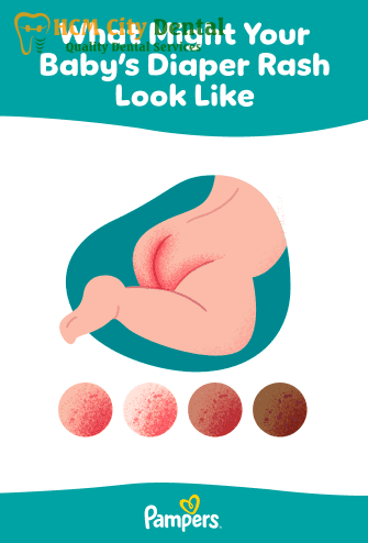 [Solve] Teething Diaper Rash: 3 Steps to Fast Relief | Dr. Cuong