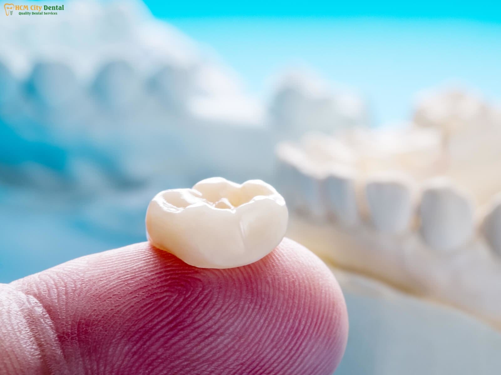 tooth-crown-pain-5-dr-cuong-hcmc-dental-clinic-dr-cuong-hcmc-dental-clinic