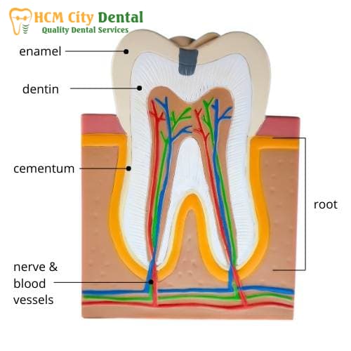 tooth-with-crown-sensitive-to-heat-4-dr-cuong-hcmc-dental-clinic-dr-cuong-hcmc-dental-clinic