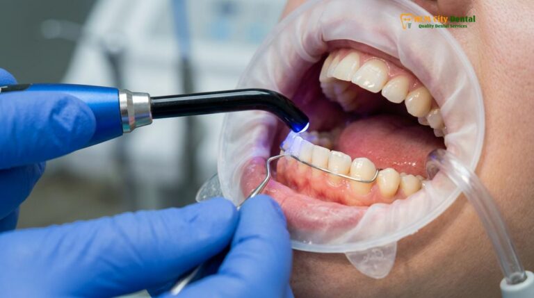 Affordable Dental Retainers Vietnam: Cost & Guide | HCMC Dental