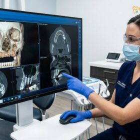 All on 4 Cost Vietnam: Complete Clinical Pricing Guide | HCMC Dental