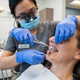 Teeth Braces Cost: Clinical Orthodontic Guide | HCMC Dental