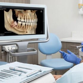 Best Clinic Wisdom Teeth Removal HCMC | HCMC Dental