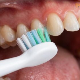Best Toothbrush for Gum Disease: Clinical Guide | HCMC Dental