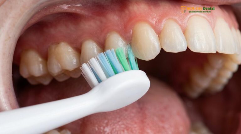 Best Toothbrush for Gum Disease: Clinical Guide | HCMC Dental
