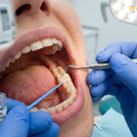 Biocompatible Dental Materials: Clinical Guide | HCMC Dental