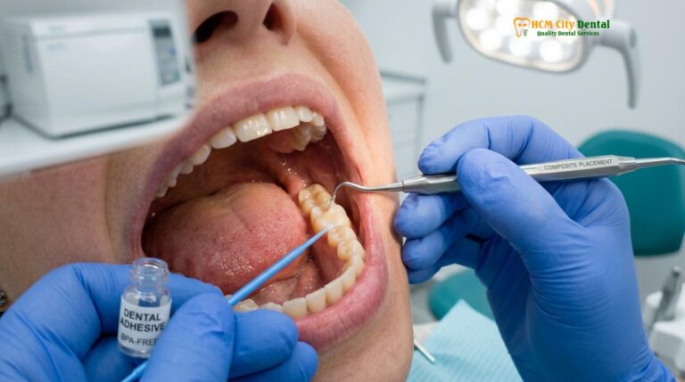 Biocompatible Dental Materials: Clinical Guide | HCMC Dental