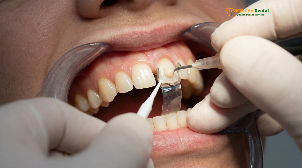 Visual description of black triangle teeth