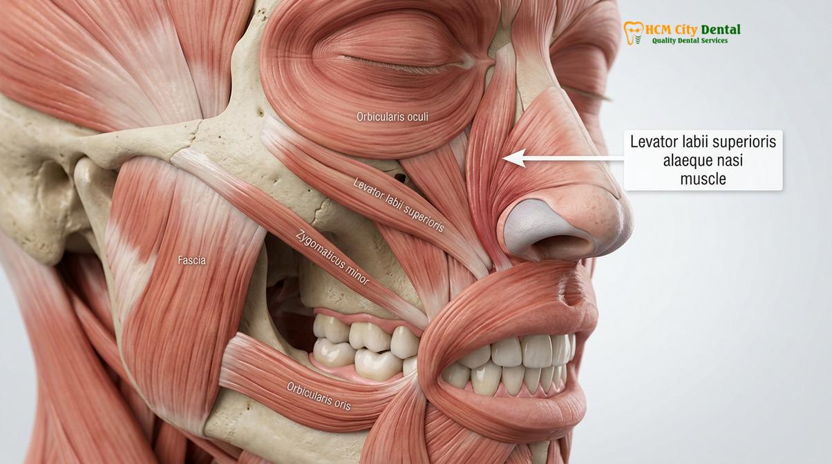 Clinical photography related to Gummy Smile Botox Vietnam