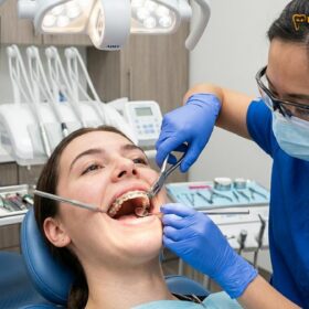 Braces Cost in Vietnam: Clinical Guide & Pricing | HCMC Dental