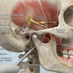 Bruxism Ear Pain Tinnitus: Clinical TMJ Connection | HCMC Dental