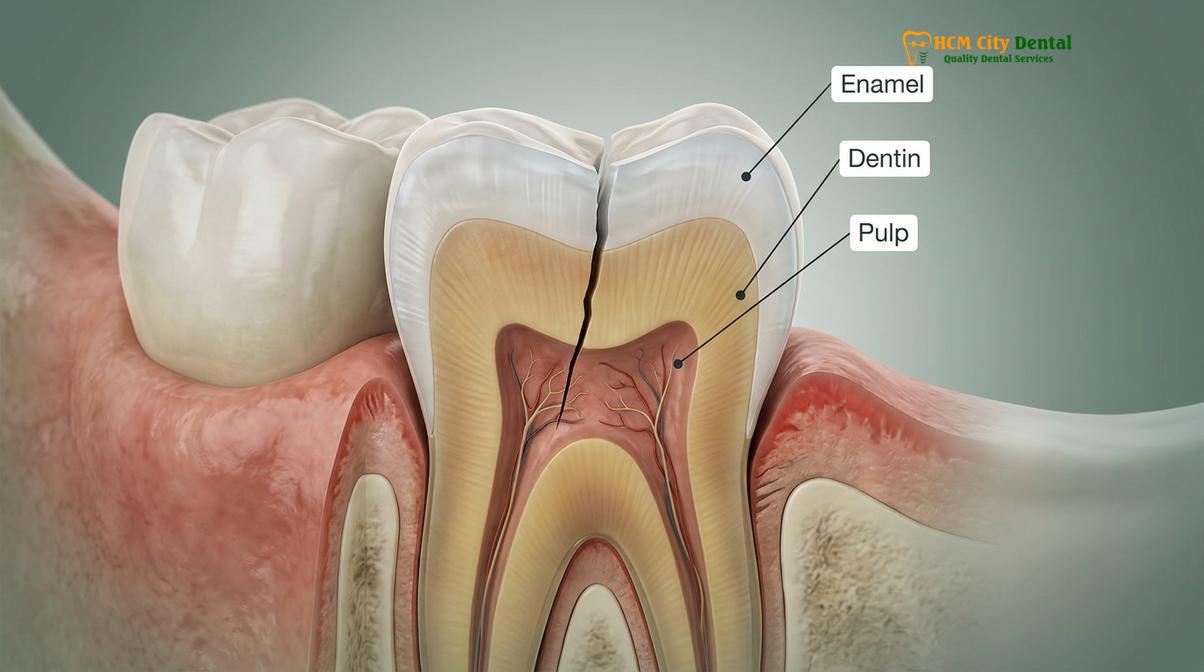 Clinical photography related to bruxism effects on teeth