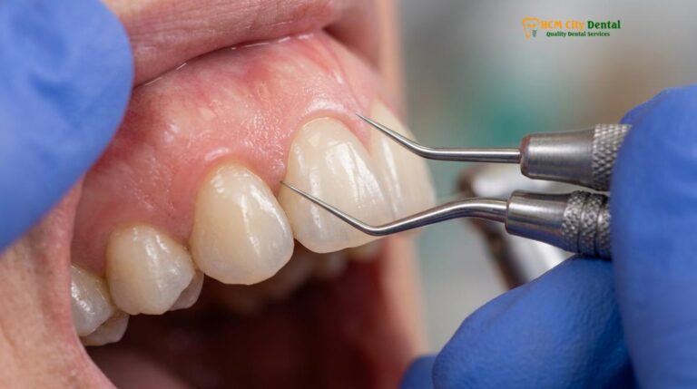 Night Guard After Dental Crowns: Clinical Guide & Protection