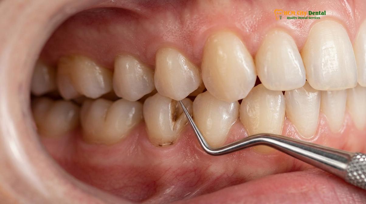 Visual description of Bruxism Symptoms and Signs