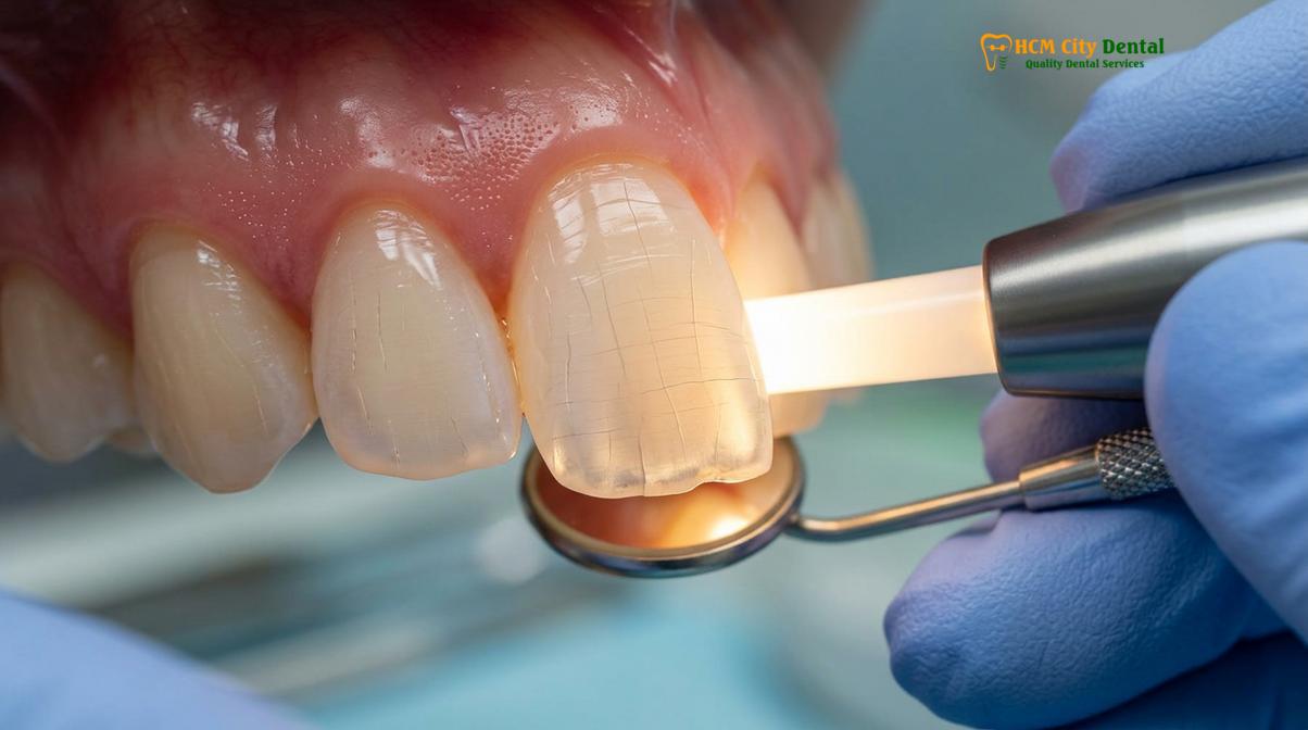 Clinical photography related to can cracked tooth heal itself