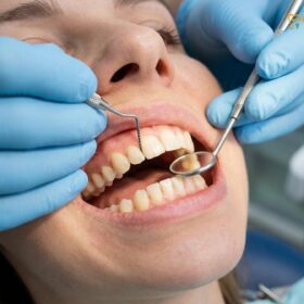 Check Up and Clean Dentist: Comprehensive Clinical Guide | HCMC Dental