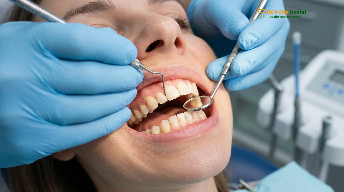 Clinical illustration of check up and clean dentist