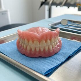 Complete vs Partial Dentures: Clinical Guide | HCMC Dental