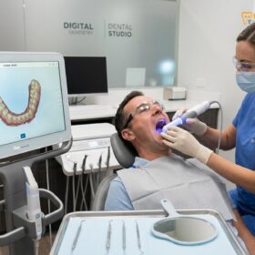 Composite Veneers Cost in Vietnam: Clinical Pricing & Material Guide