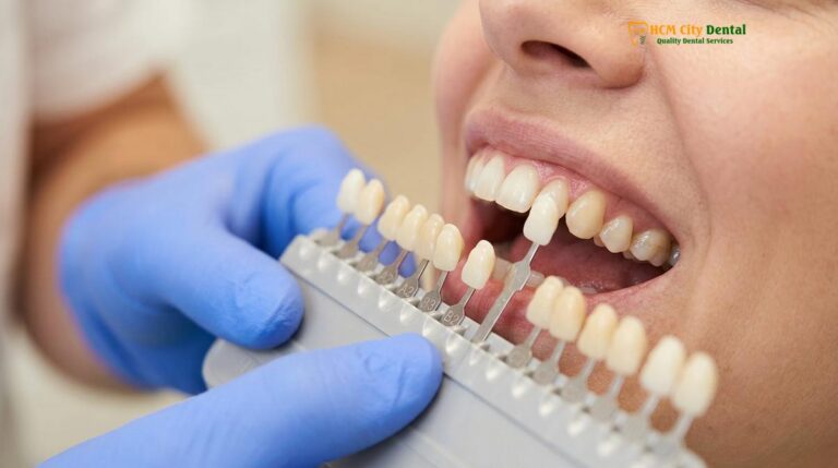 Color Matching Dental Inlays: Clinical Shade Selection & Aesthetics