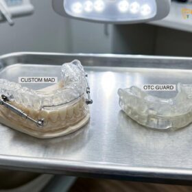 Custom vs OTC Snoring Mouthpiece: A Clinical Comparison