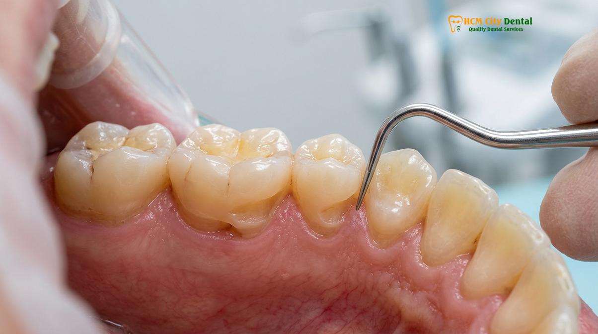 Clinical photography related to jaw clenching during day